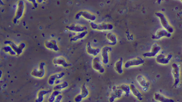 '뇌를 파먹는 아메바' 네글레리아 파울러리